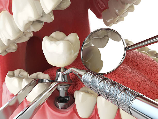 Best Emergency Root Canal Treatment in Arkansas City, KS